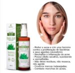 Creme Anti Acne Oil Free Flora Amazonica 100ml Promoç (1)